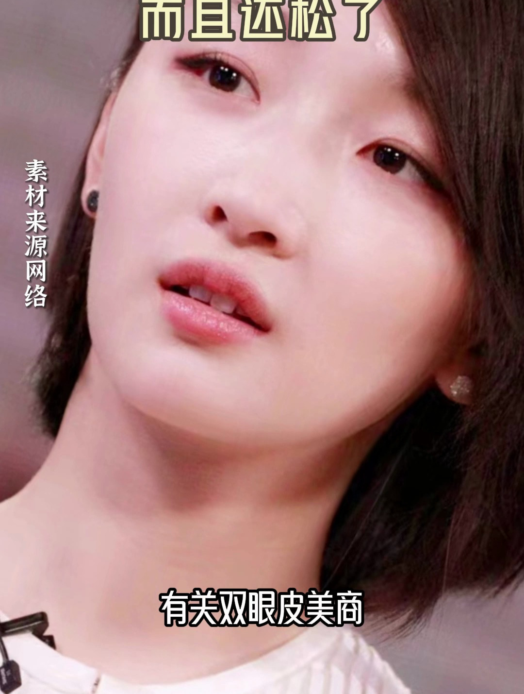 周冬雨双眼皮变化史,get双眼皮美商!