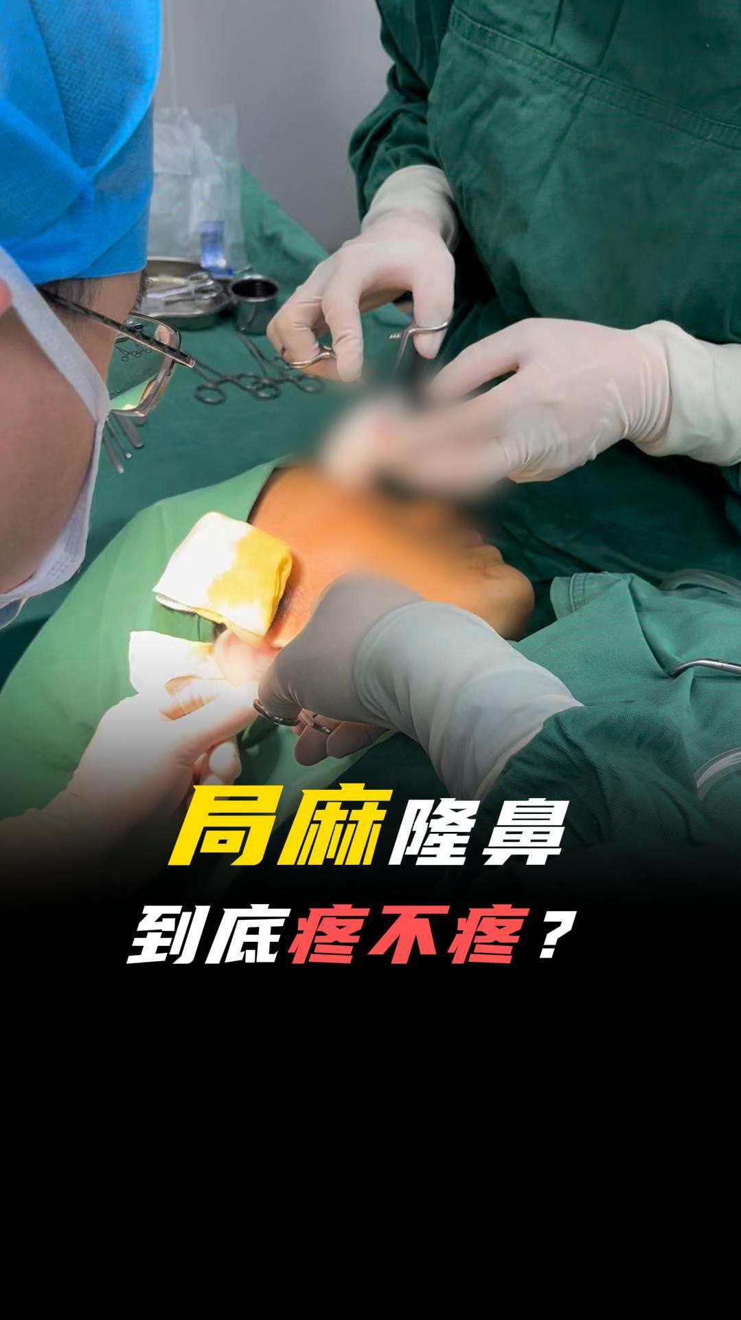 隆鼻手术用局麻,会很疼吗?