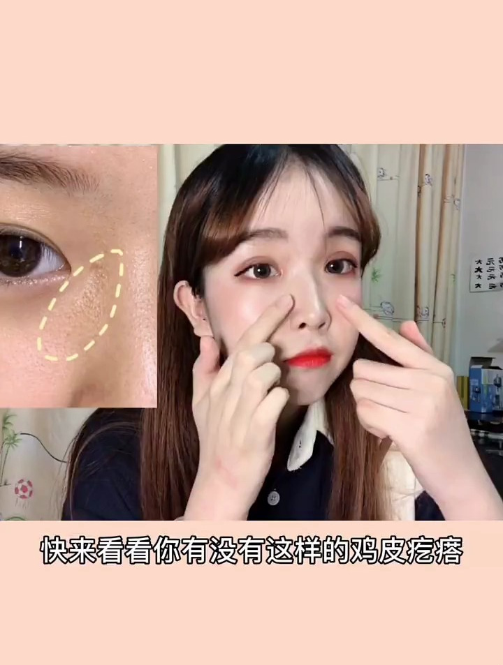 姐妹们 你们有没有小疙瘩 快来看看到底是什么