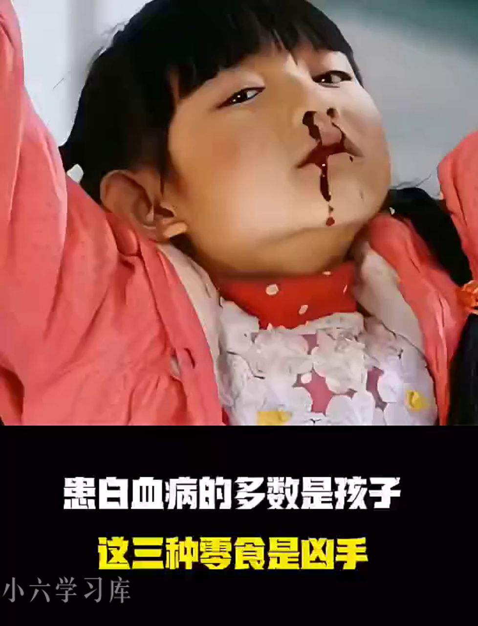为啥小孩容易得白血病?这仨零食别再给孩子吃了!