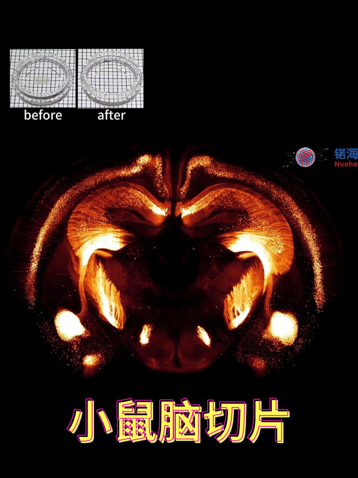 小鼠脑冰冻切片透明化三维成像