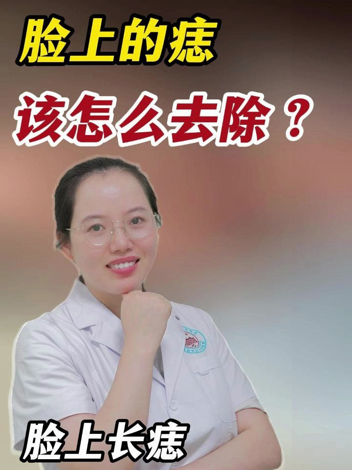 脸上长痣怎么办?
