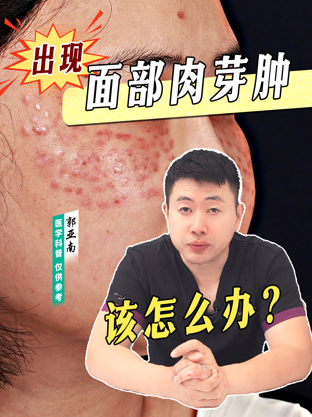 郭亚南:肉芽肿的治疗