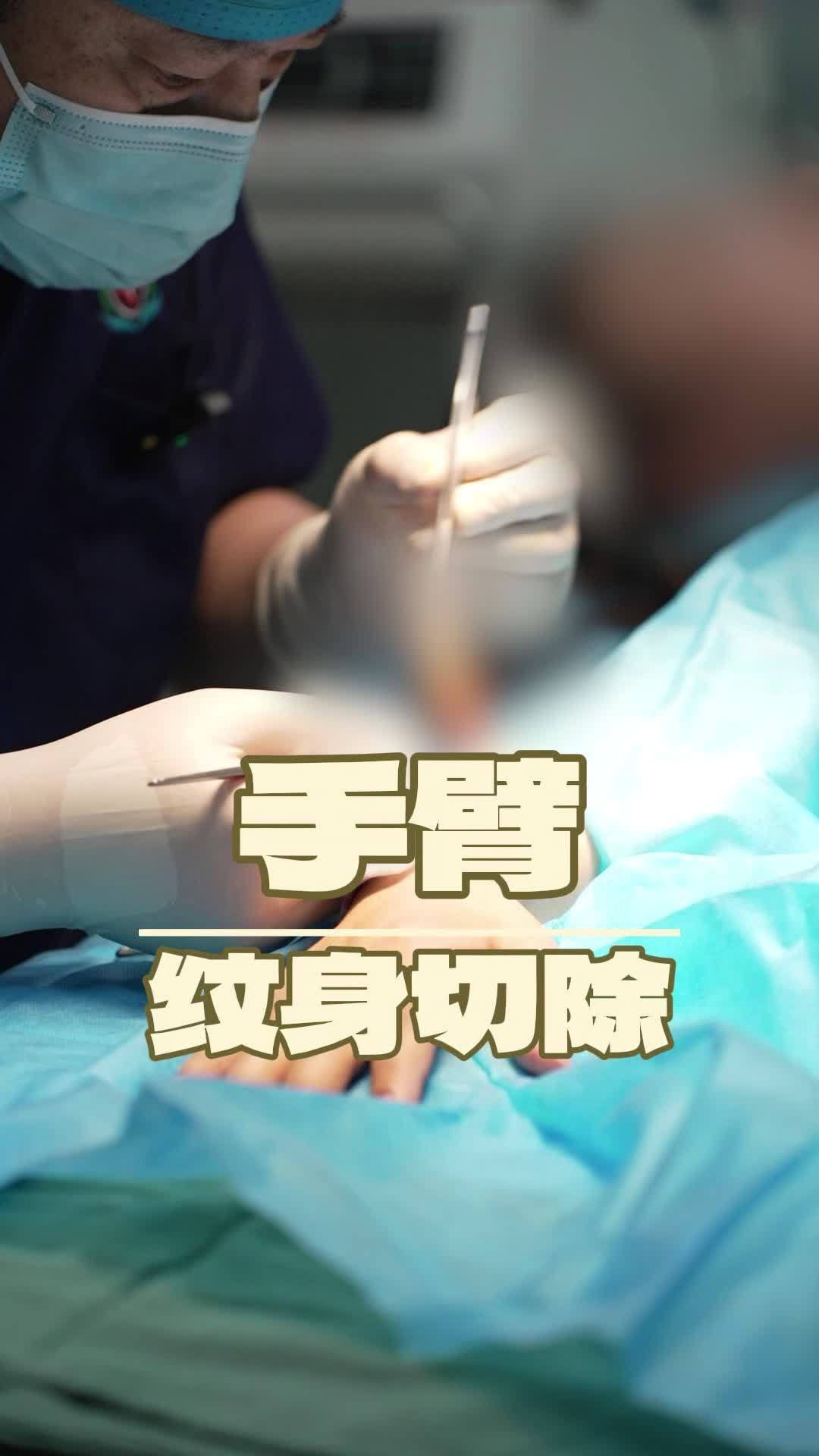 手臂纹身切除~蝴蝶结