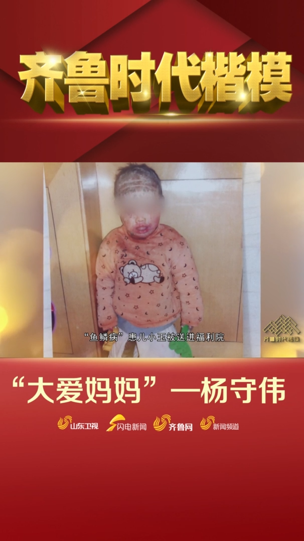 齐鲁时代楷模杨守伟:鱼鳞病孤弃儿童在她的呵护下收获崭新人生