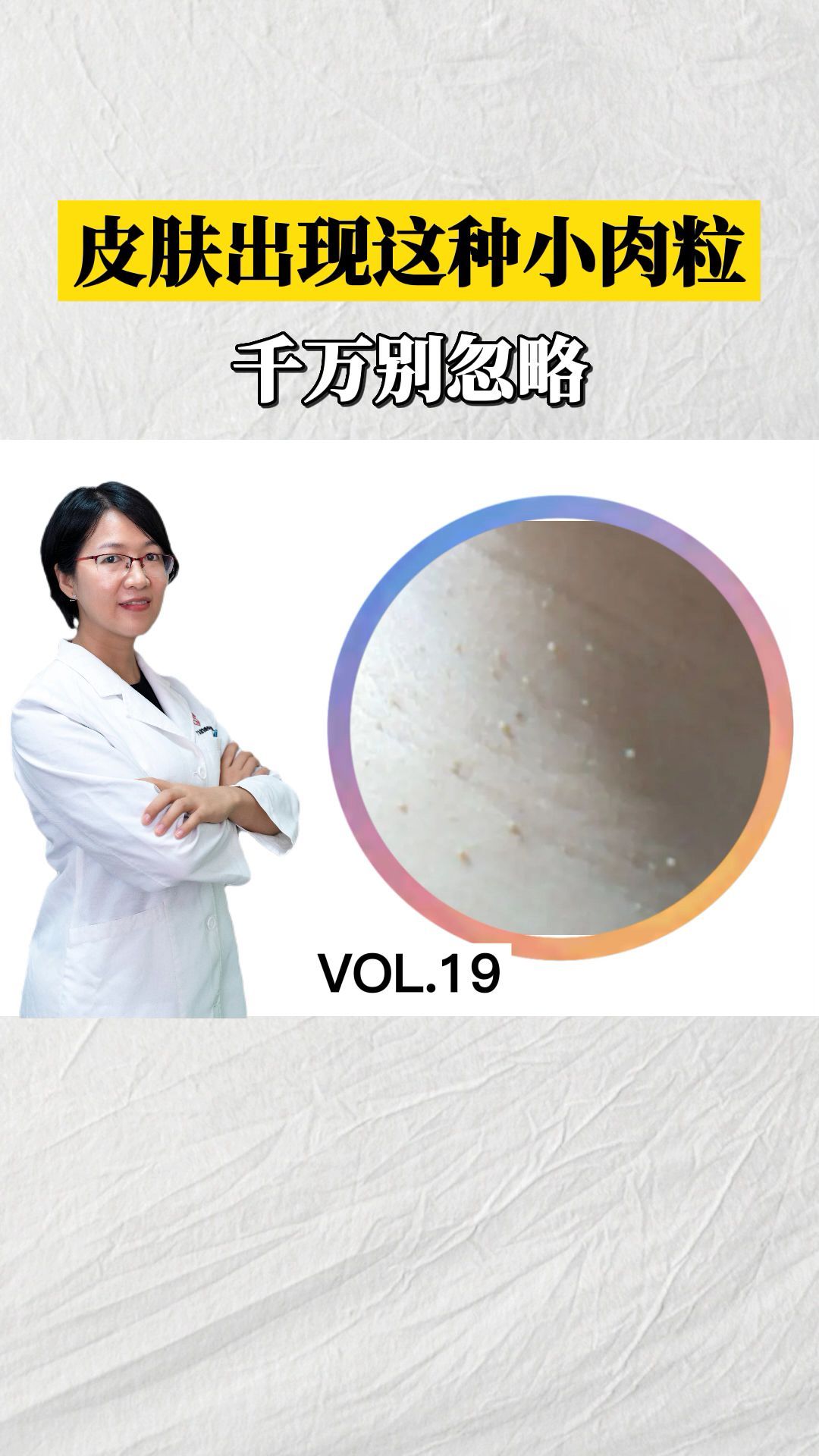 皮肤出现这种小肉粒,千万别忽略