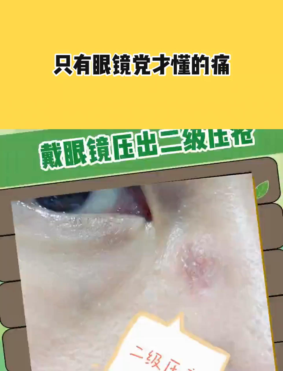 什么?原来这是压疮?