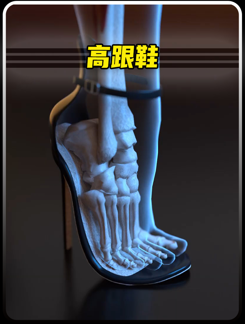 长期穿高跟鞋,身体会发生什么变化?