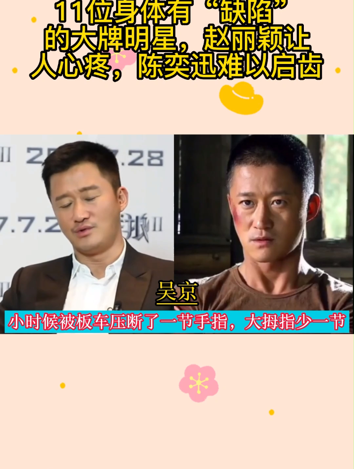 11位身体有“缺陷”的大牌明星,赵丽颖让人心疼,陈奕迅难以启齿