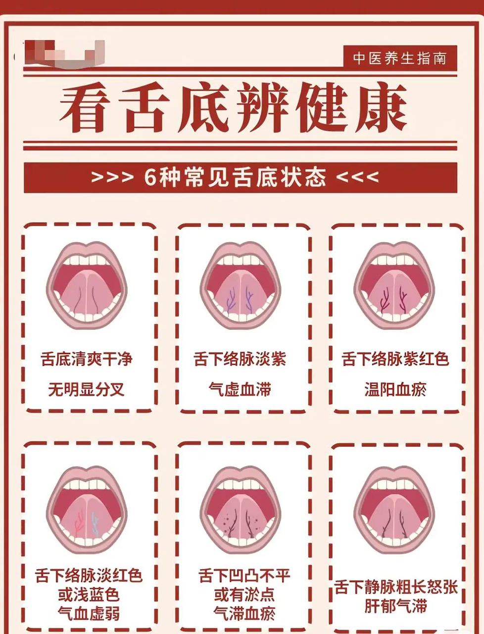 瞧舌底知健康|舌头下面青筋啥样才算正常?