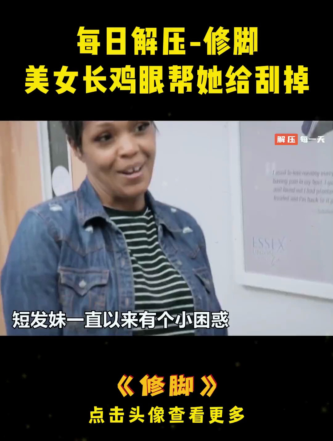 美女长鸡眼帮她给刮掉了,过程超级解压