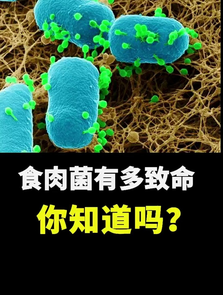王大爷只因洗了一次虾,感染食肉菌命就没了