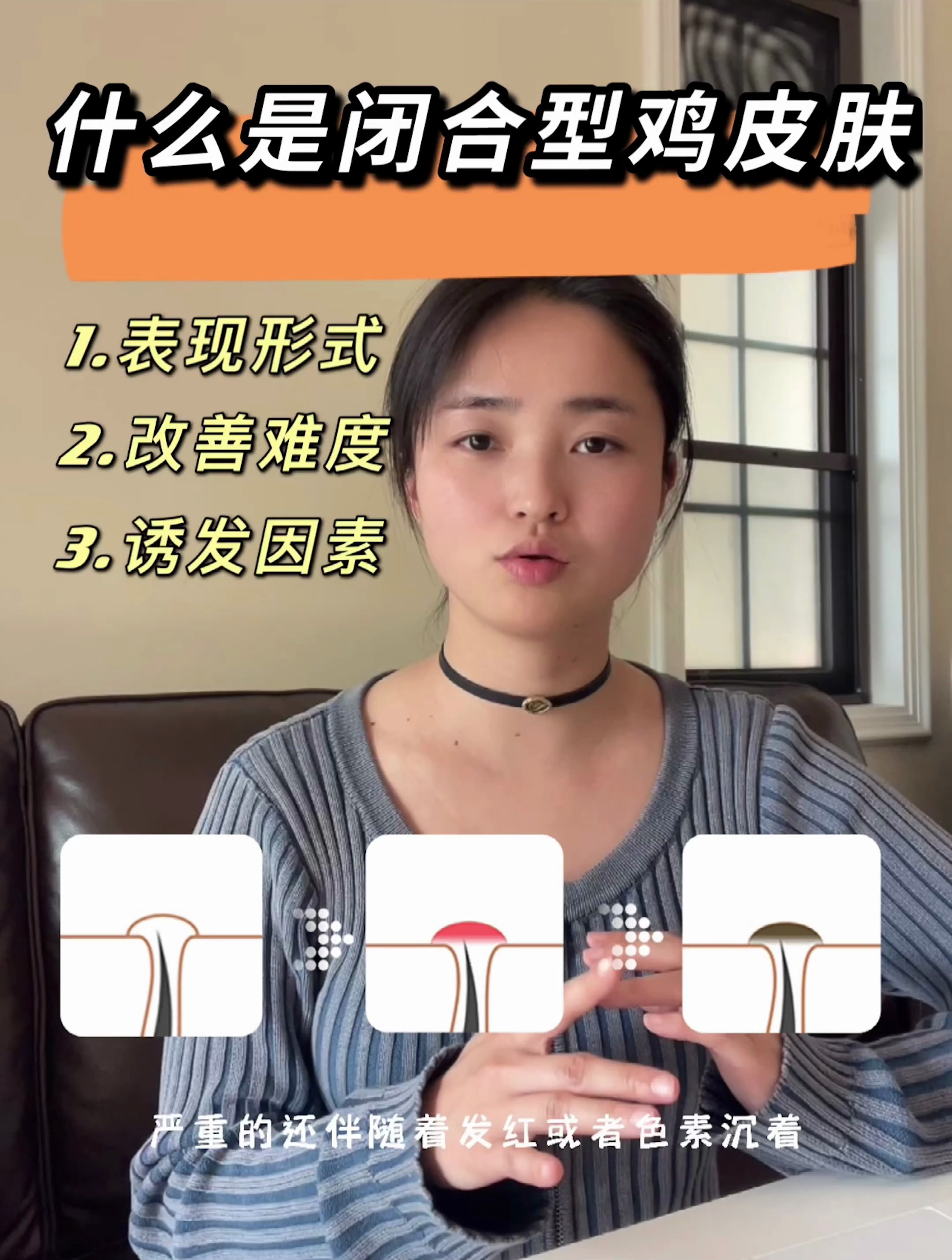 什么是闭合型鸡皮肤