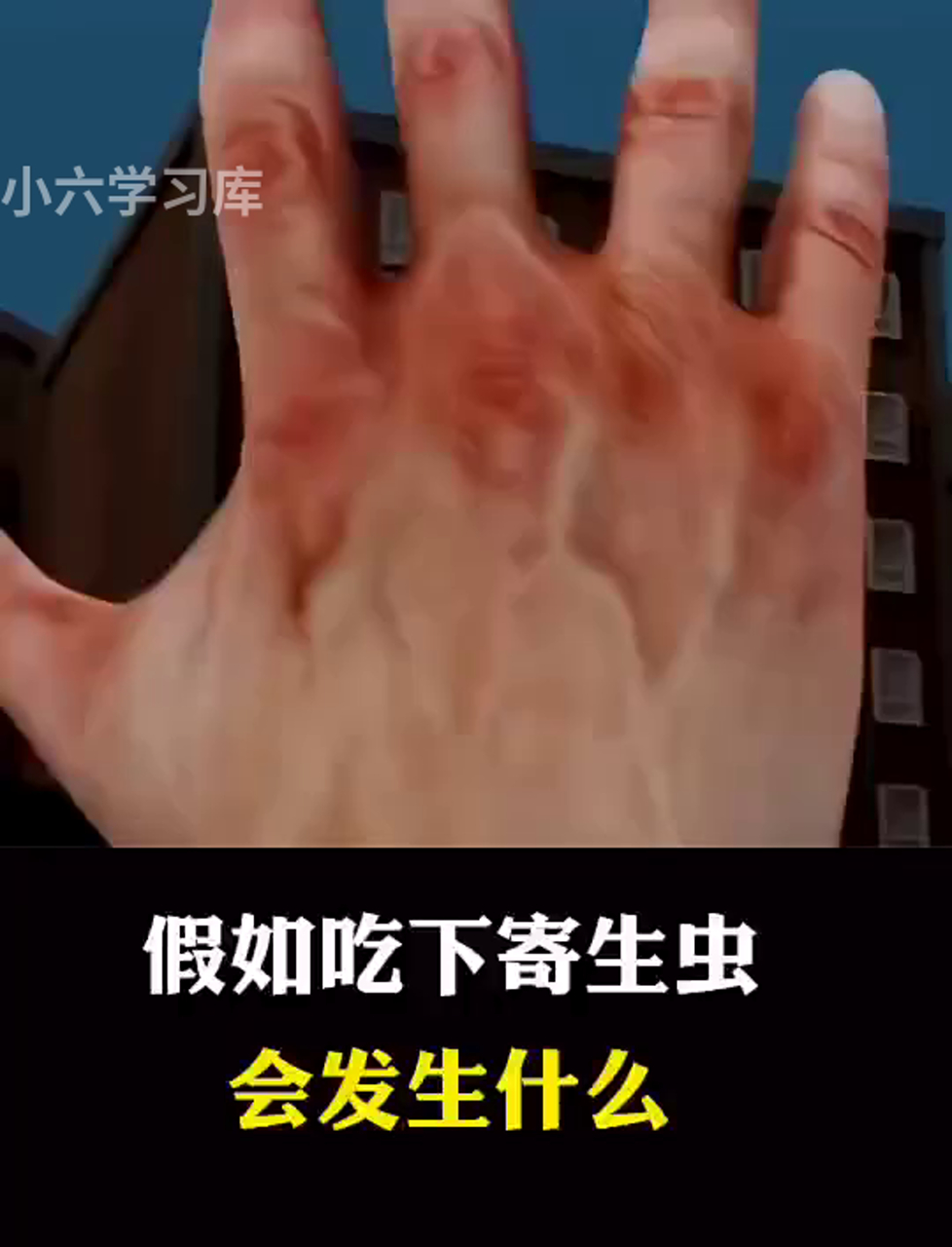 肚子里进了寄生虫,会有啥后果?