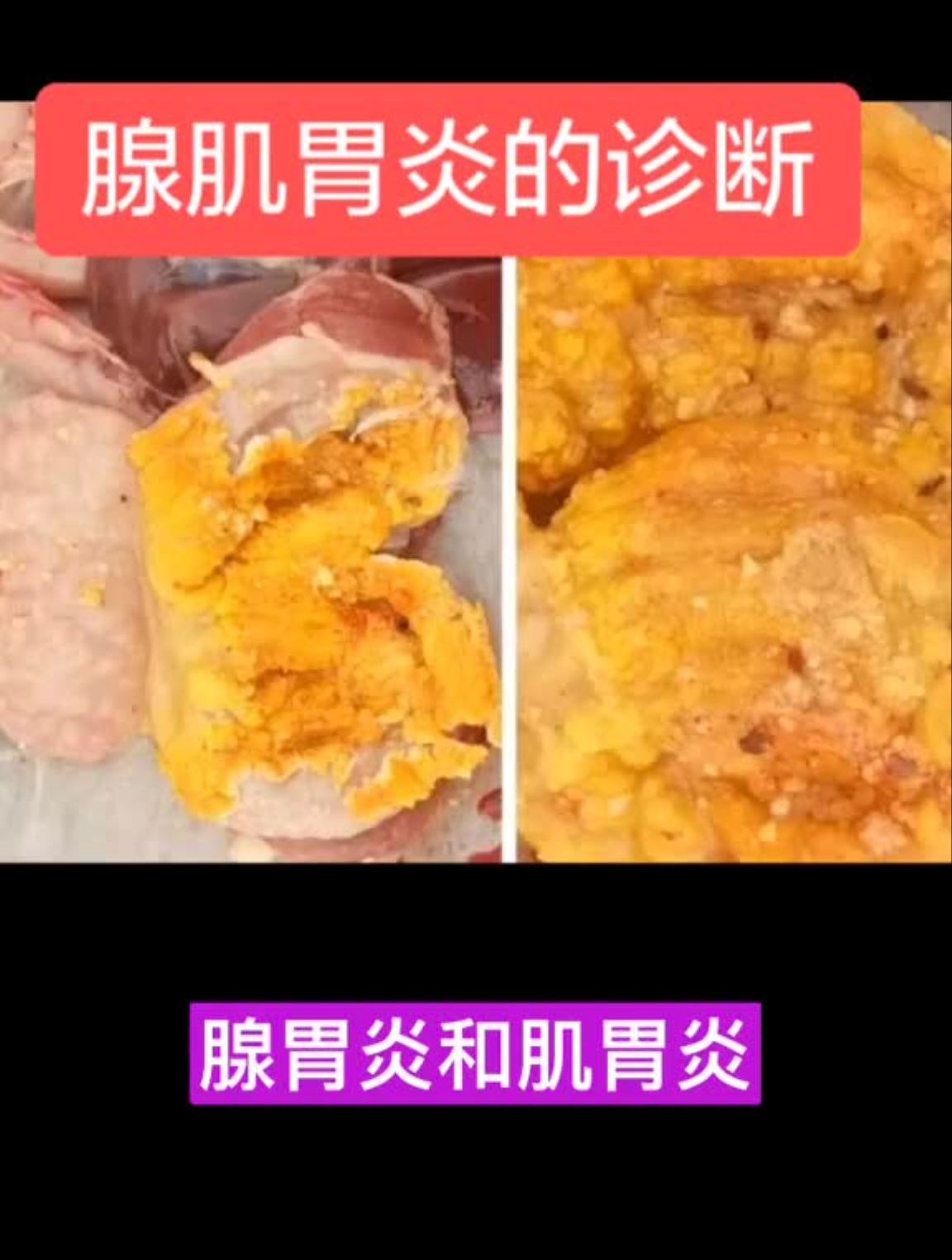 鸡腺肌胃炎的诊断与防治,今晚9点直播间为大家详细讲解