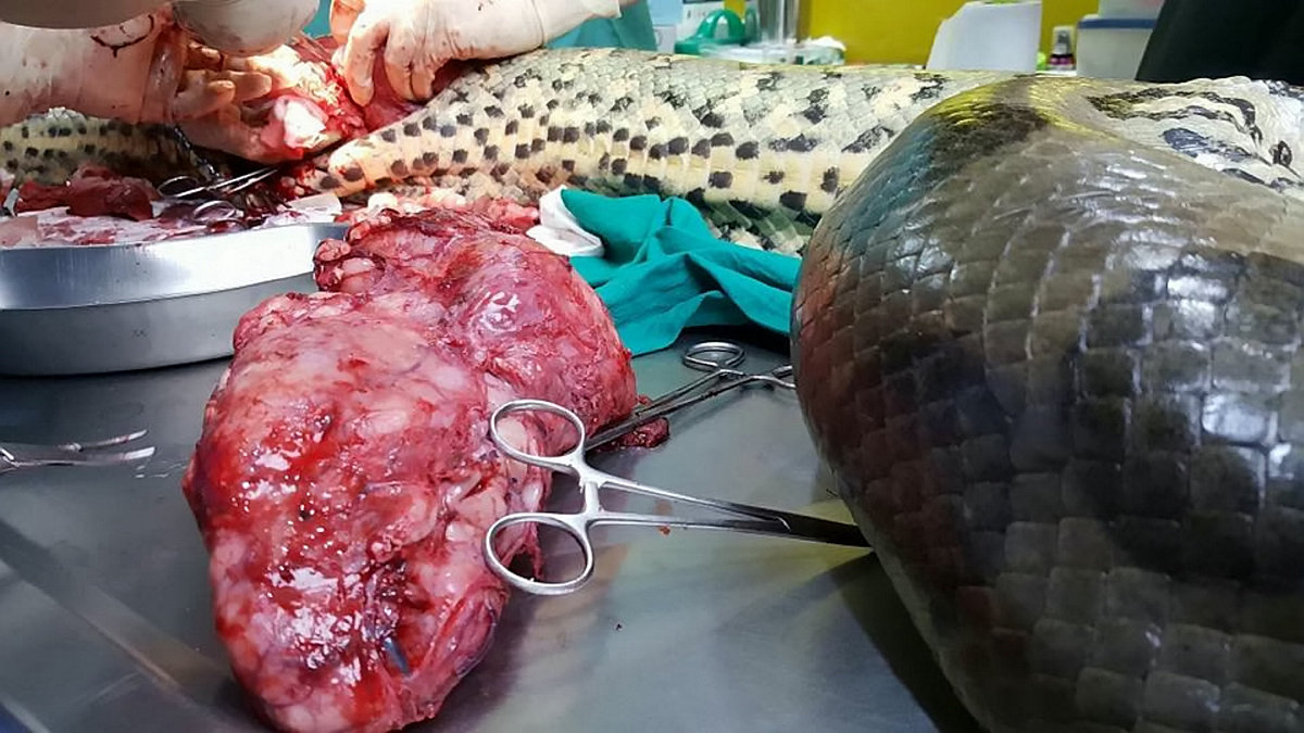 胸腺囊肿多大需要做切除手术吗