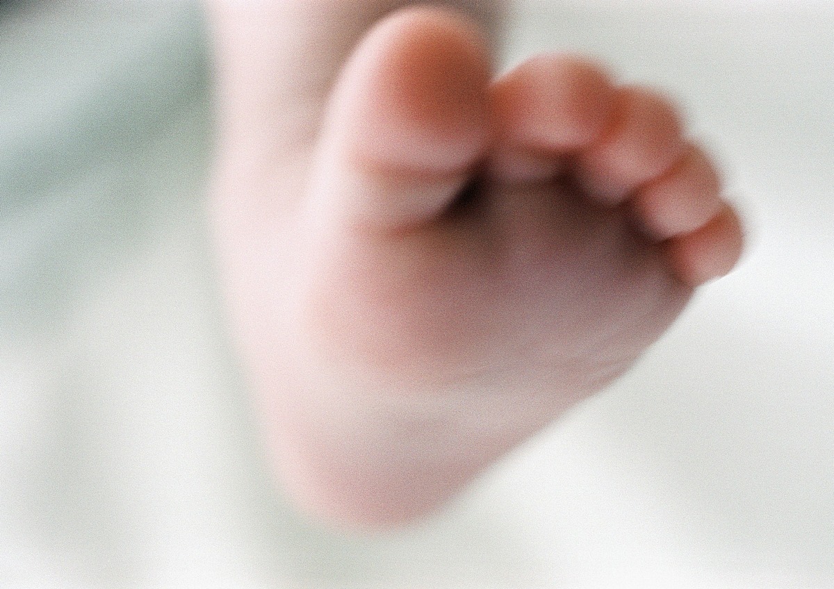 足底鸡眼的治疗方案