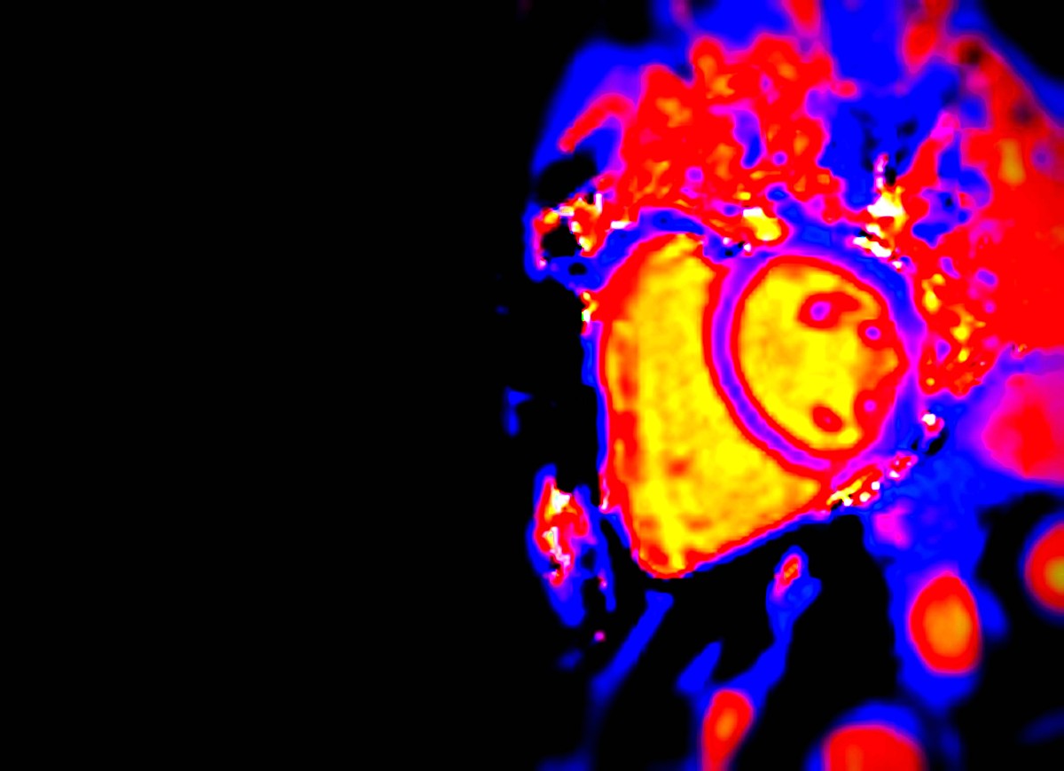 人的头几岁停止变大，