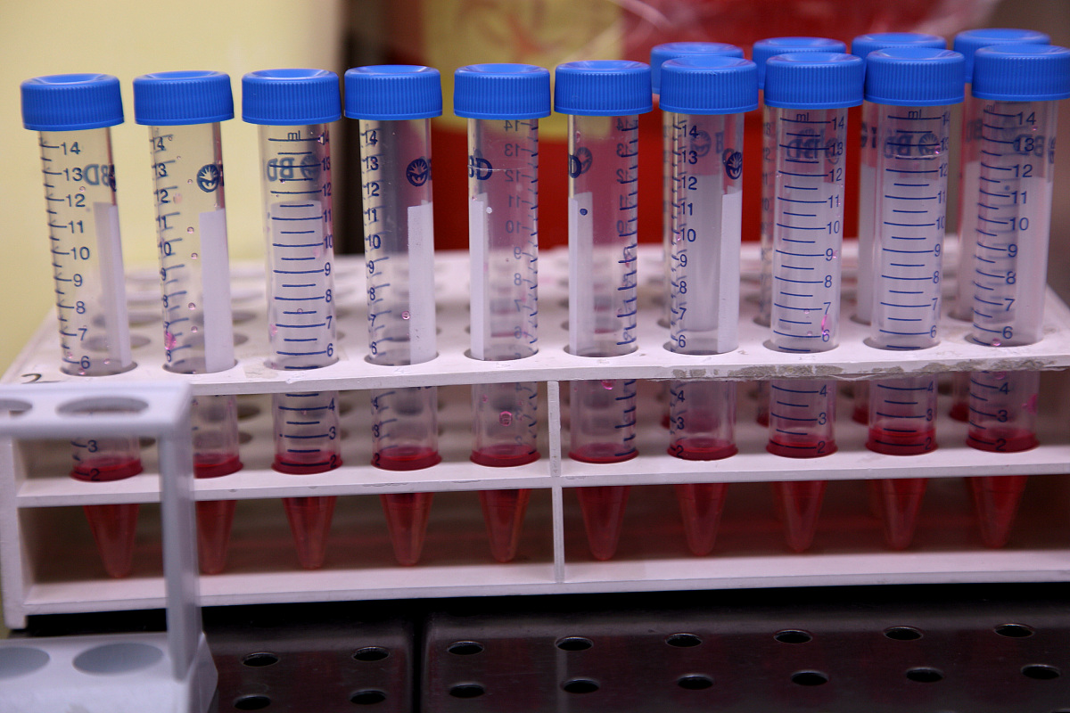 超声造影特征与影像学表现完美契合：病例分析