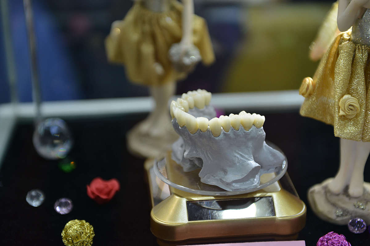 单层曝光时间如何影响齿科模型质量？