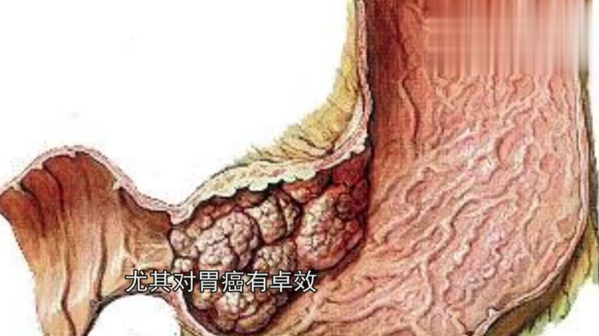 农村这种植物,是亚洲最好的“山珍”,韩国日本高价收购,一斤上百