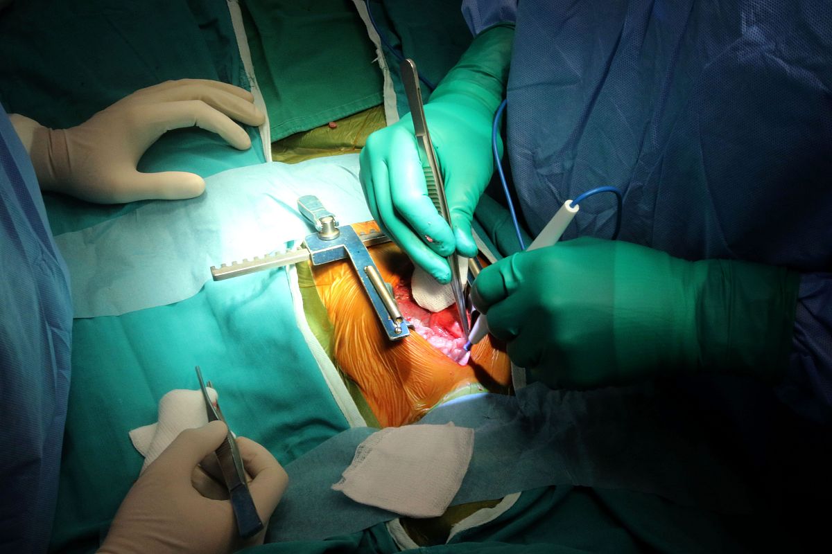 paediatric heart surgeon issam al-rassi performs a heart operati