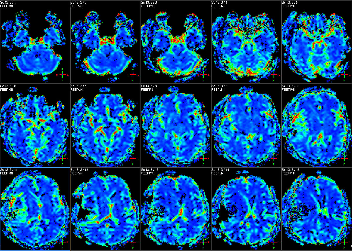 按照上述和 脑部专用正电子发射型计算机断层显像PET设备相关的大纲生成PPT内容每一页需要包括以下内容：-标题；-关键要点；-正文内容。
