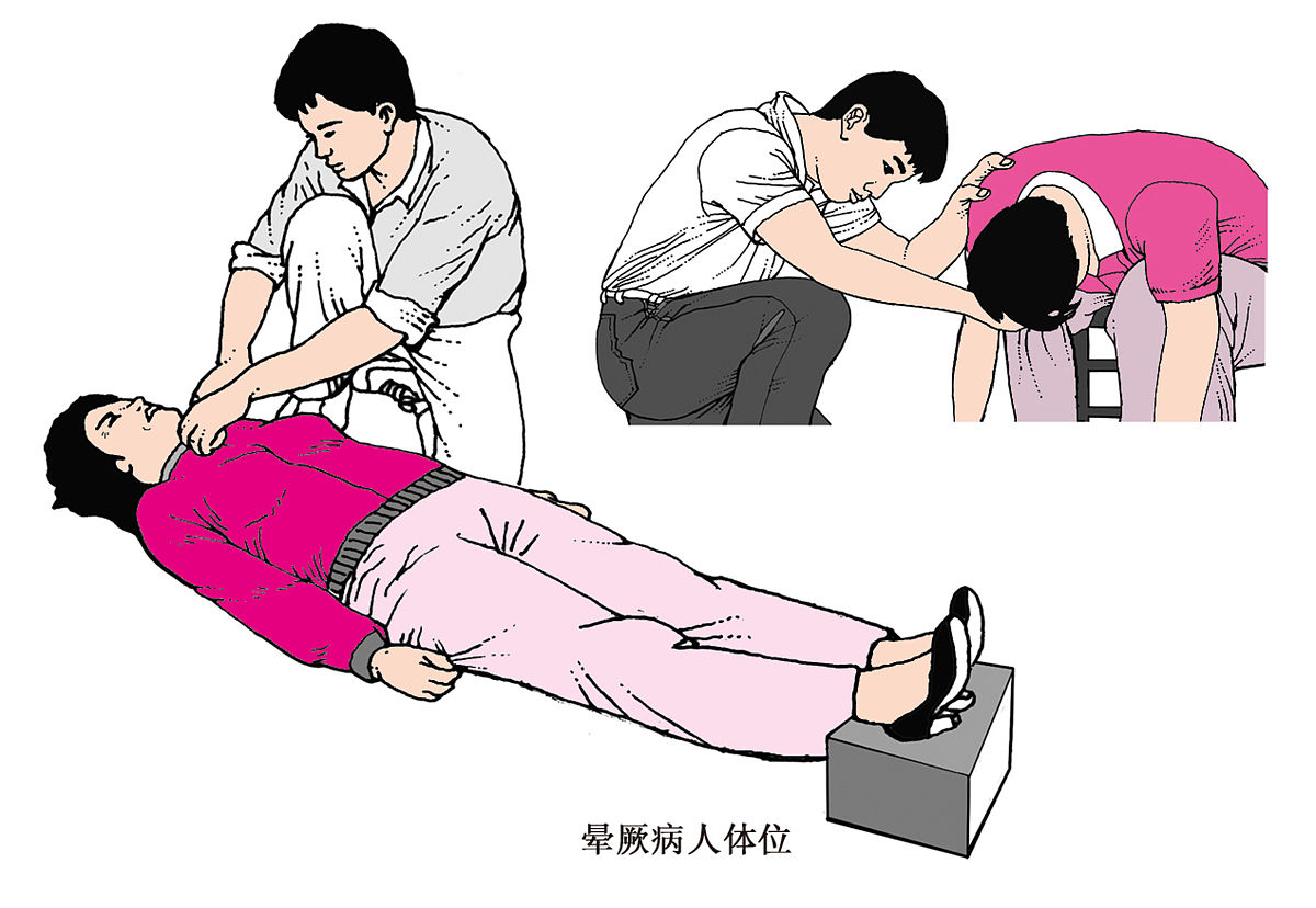 新生儿窒息怎么办？心肺复苏术 (CPR) 急救指南