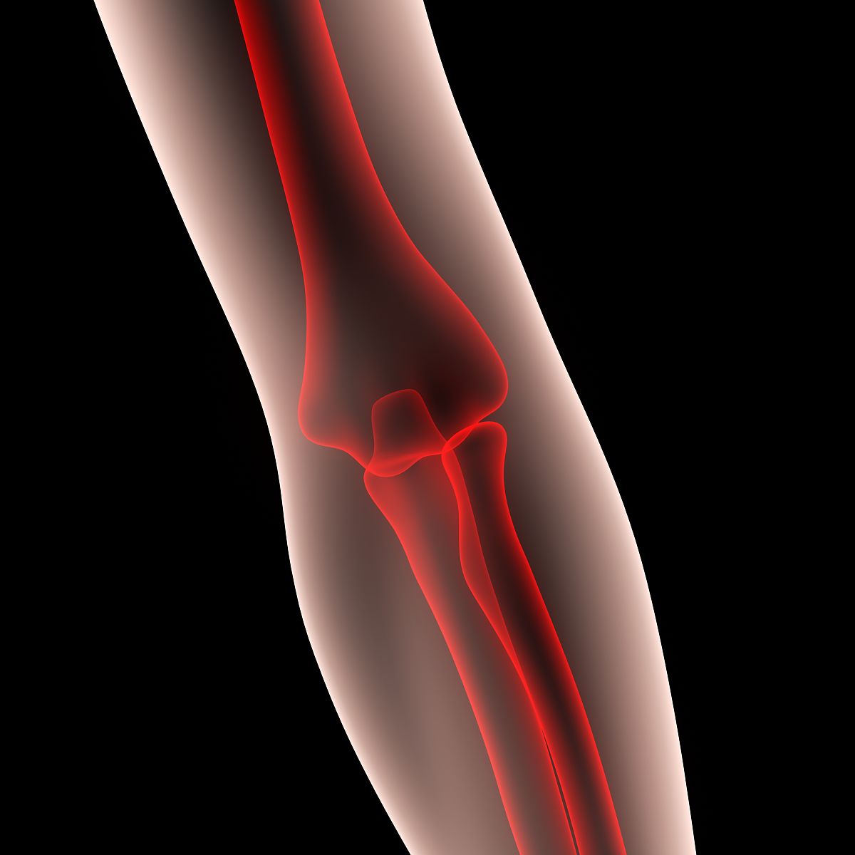 Premium Elbow Support for Athletes, Fitness Enthusiasts & Everyday Comfort | Speed Sell