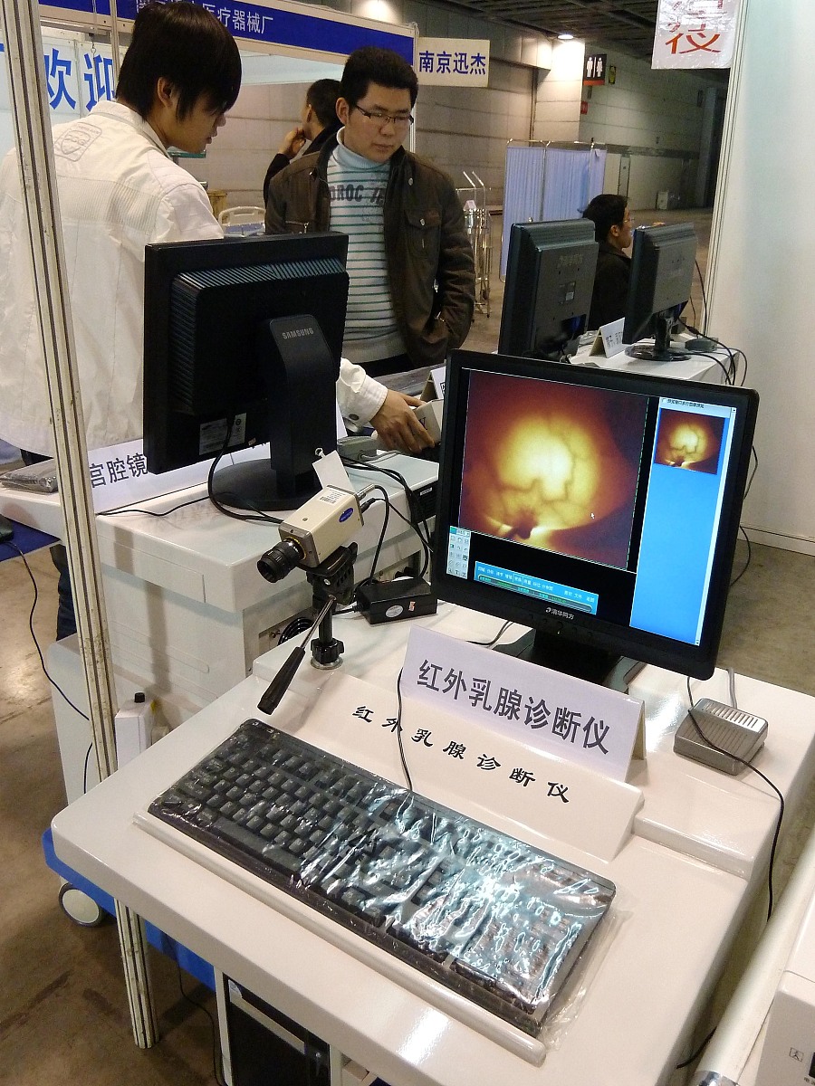 乳腺辅助诊断系统：提高诊断准确率和早期诊断率的关键