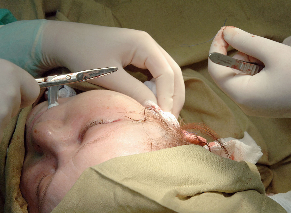 乳房病损切除术1次皮肤缝合术皮肤和皮下组织脓肿抽吸术开腹探查术肛周脓肿切开引流术开腹探查术乳房切开引流术下肢动脉造影以上每行数据加顿号整理出一行