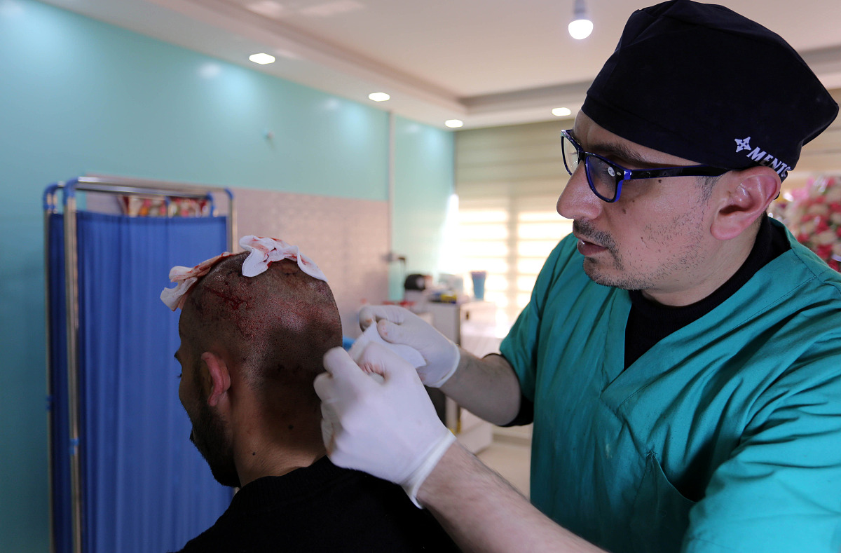 你正在写一篇长沙植发价格一般多少钱中文问答每一行必须使用p标签。回答内容必需精简并且专业性要高字数必须控制在200-300字内结构必须符合SEO优化内容必须每一行开头使用p标签结尾使用p 标签。避免使用本文中和结论的术语。在可能的情况下使用具体的现实世界的例子、引证和数据。将所有内容设置为markdown格式。这篇文章应以友好的语气和鼓舞人心的写作风格来写。要求内容中必须禁止出现电话、网址、超级链