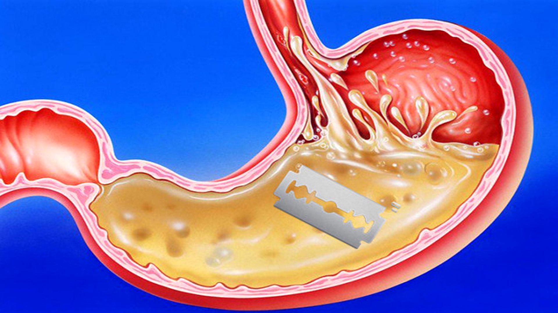 [图]10个关于人体的有趣冷知识,胃酸强大到能溶解刀片?