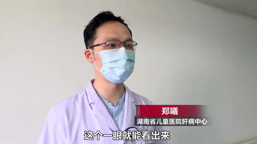 【爱吃肉爱玩手机不爱动!&nbsp;8岁男孩体重近百还有脂肪肝】湖南男孩壮壮今年8岁,从小就食欲较好