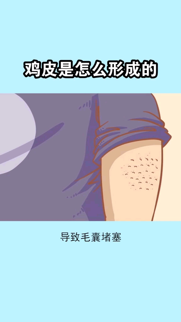#无惧素颜#鸡皮是怎样形成的?