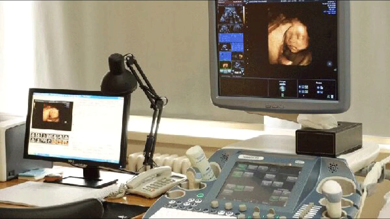 四维彩超检查单越看越有意思,孕妈们你们都自己学会看了吗