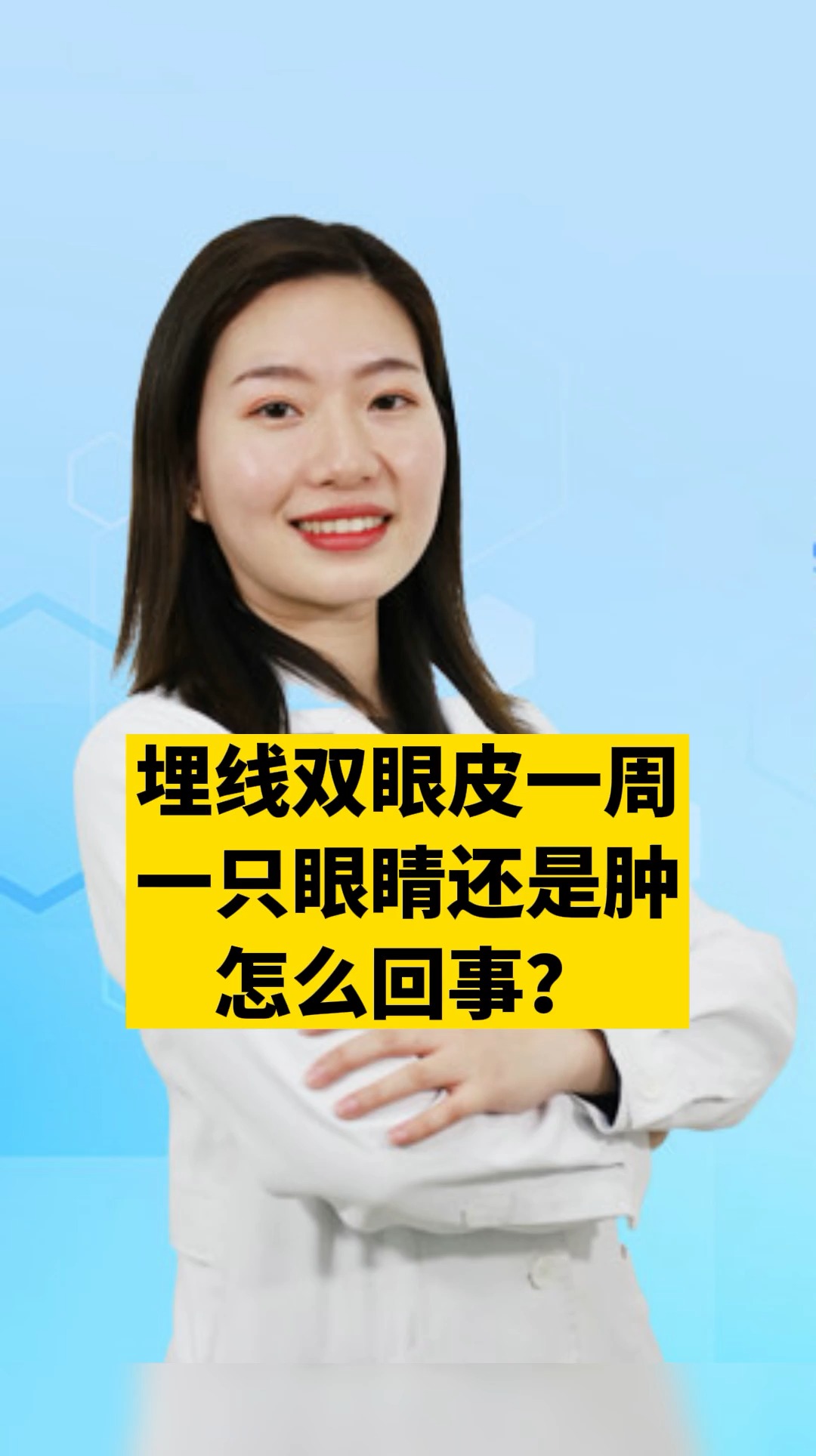#健康养生#埋线双眼皮一周,一只眼睛持续肿胀,怎么回事?
