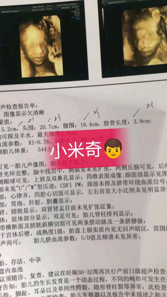 #四维看男女#好奇是米妮还是米奇,点我头像