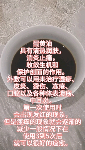 鸡蛋油 蛋黄油具有清热润肤,消炎止痛,收敛生机和保护创面的作用。外敷可以用来治疗