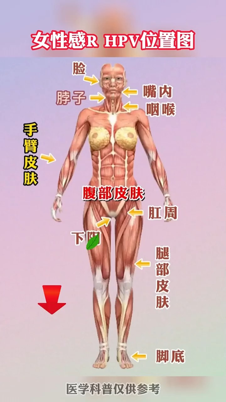 #关爱女性健康#女性感染HPV位置图