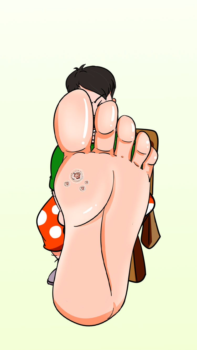 还在鸡眼跖疣傻傻分不清,你真的只是鸡眼吗