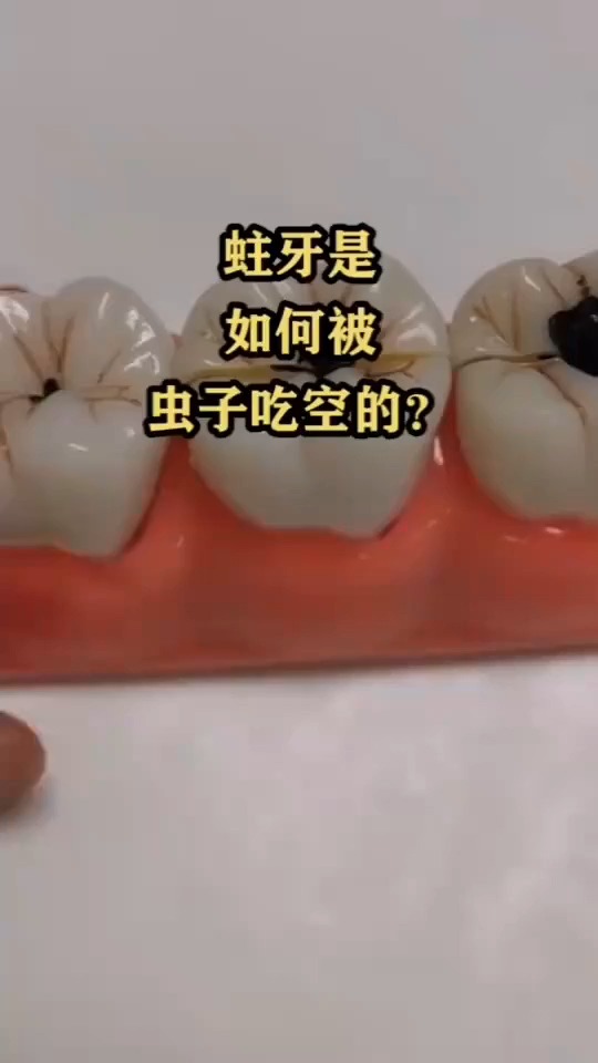 蛀牙是如何被虫子吃空的?