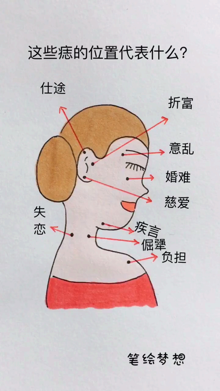 这些痣的位置代表什么?