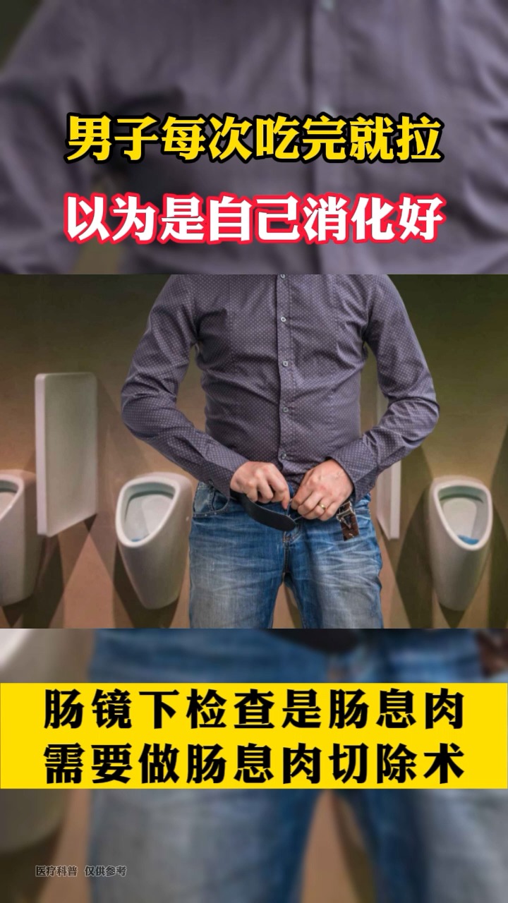 #生活医疗科普#肠息肉有什么症状呢？