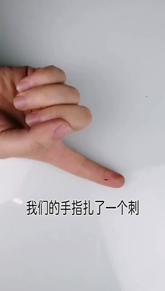 #生活小妙招#轻松去除扎进手里的刺