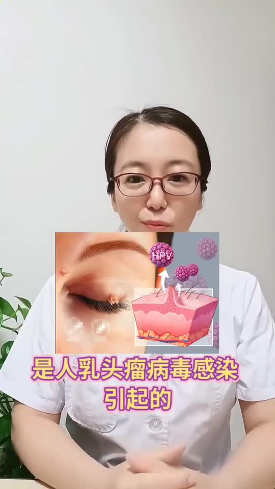 身上长的小肉丁,千万别大意