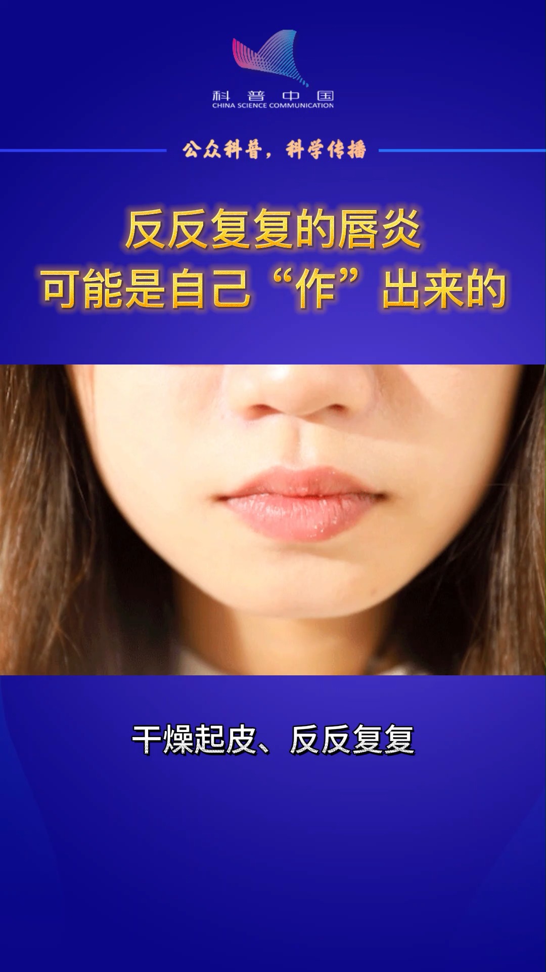 #知识科普#唇炎反复无常?你有没有被唇炎缠身的困扰?