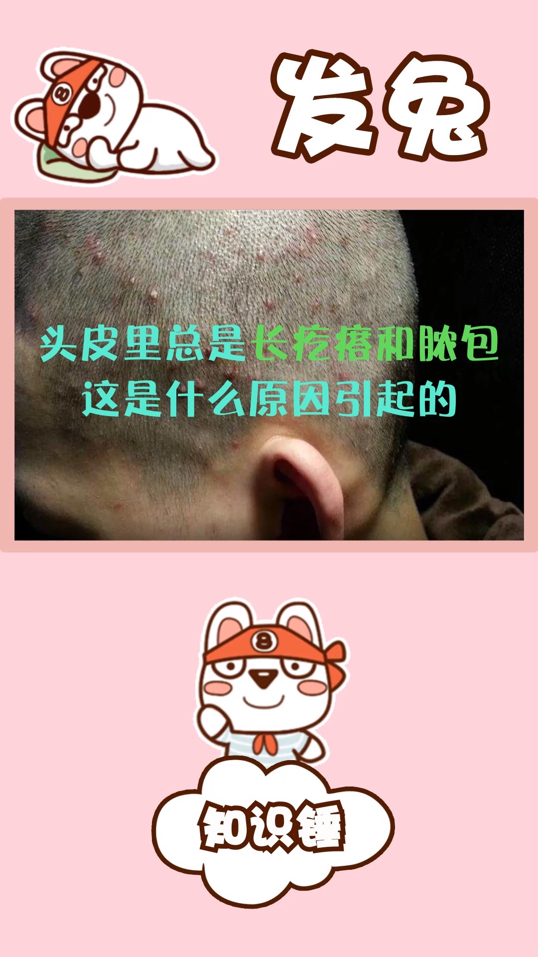 头皮里总是长疙瘩和脓包,这是什么原因引起的啊?