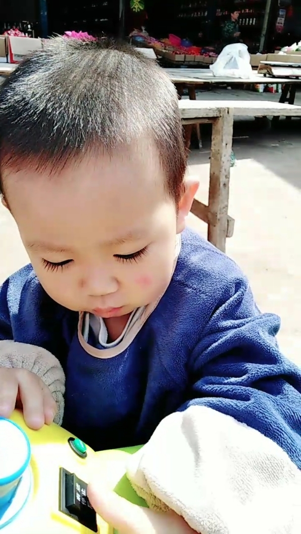 脸上长的是什么??那么大一颗