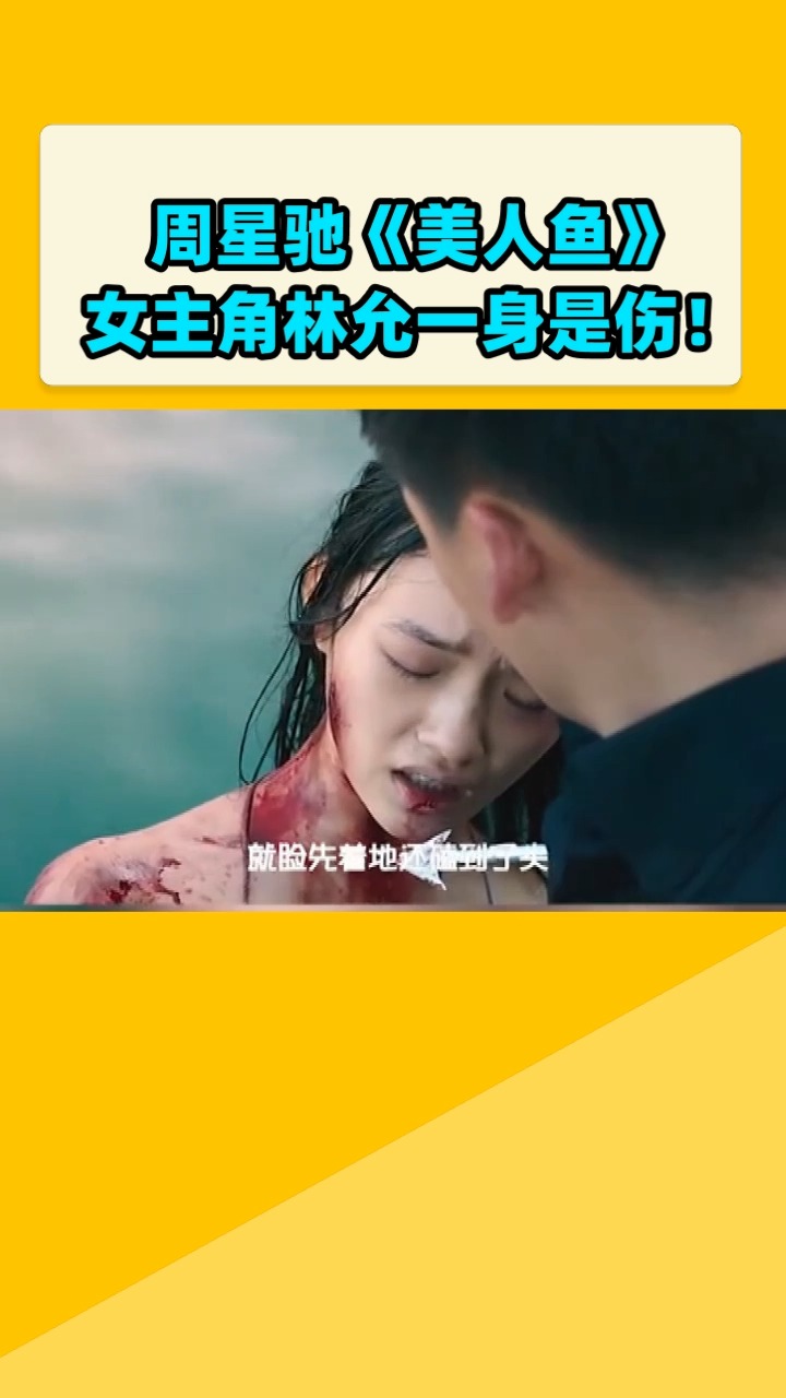 周星驰《美人鱼》女主角林允一身是伤!